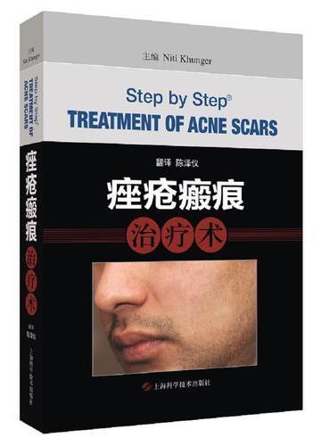 痤疮瘢痕治疗术