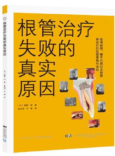 根管治疗失败的真实原因