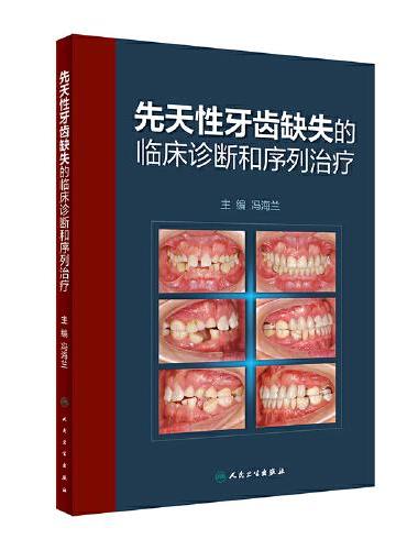 先天性牙齿缺失的临床诊断和序列治疗