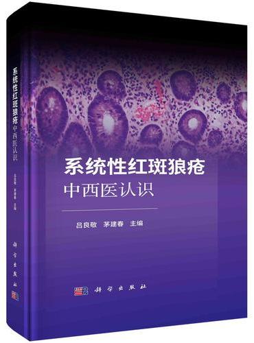 系统性红斑狼疮中西医认识