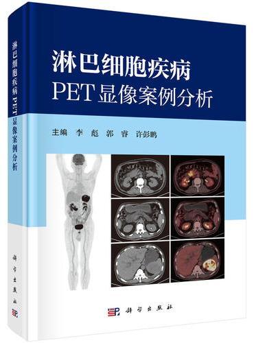 淋巴细胞疾病PET显像案例分析