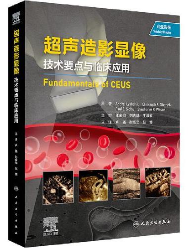 超声造影显像：技术要点与临床应用