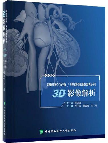 副神经节瘤/嗜铬细胞瘤病例3D影像解析