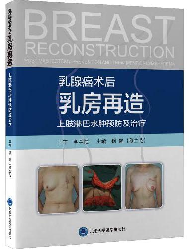 乳腺癌术后 乳房再造 上肢淋巴水肿预防及治疗