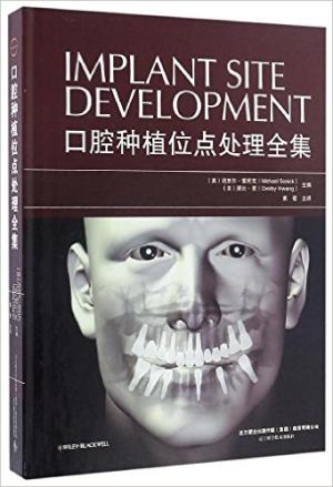 口腔种植位点处理全集