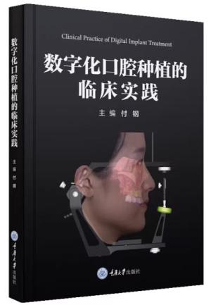 数字化口腔种植的临床实践